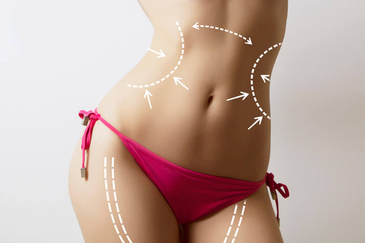 vaser liposuction procedure
